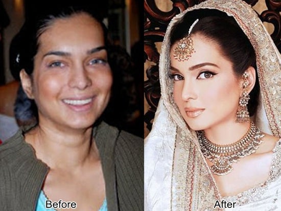 amna haq failed plastic surgery