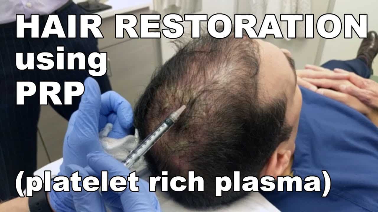 PRP Platelet-Rich Plasma: Is It An Effective Hair Loss Treatment?