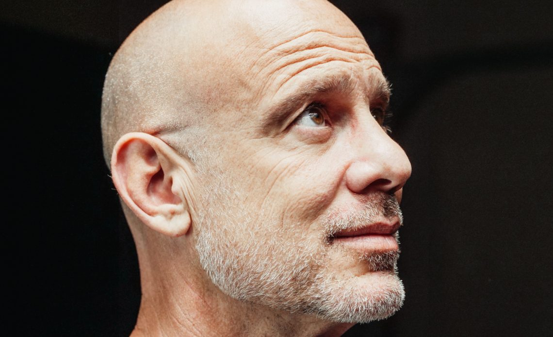types of alopecia
